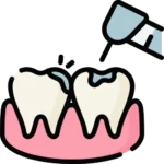 dental filling